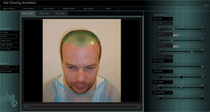Wien-News.de - Wien Infos & Wien Tipps | Programm „Hair Drawing Animation“ ermglicht virtuelle Haartransplantation