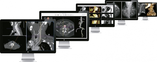 News - Central: aycan OsiriX PRO – Die Highspeed-Workstation fr Routine- und Spezialaufgaben.