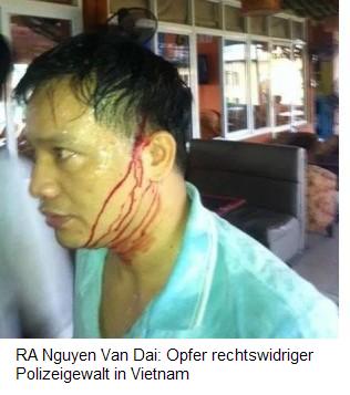 Deutschland-24/7.de - Deutschland Infos & Deutschland Tipps | A Nguyen Van Dai: Opfer rechtswidriger Polizeigewalt in Vietnam